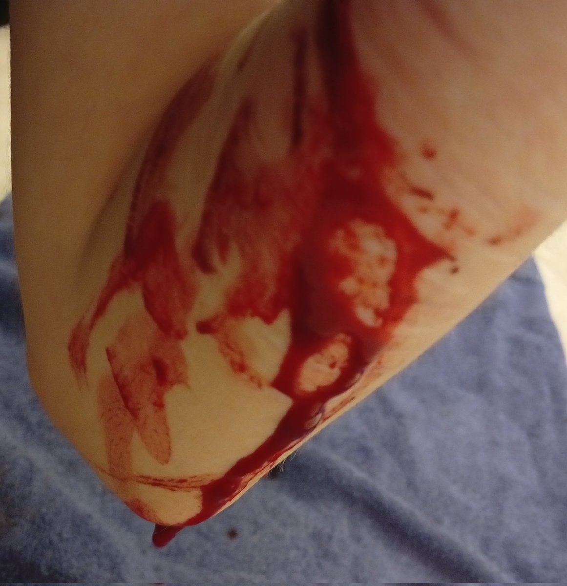 Still in the psychward but I got my phone now