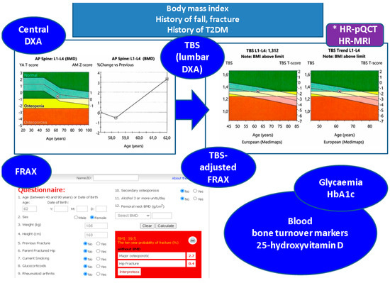 JCM_MDPI's tweet image. #mdpijcm
#Highly_Cited_Paper🔥
Citations 22👏
#Trabecular_Bone_Score (TBS) in Individuals with Type 2 #Diabetes_Mellitus: An Updated Review
by Alexandra-Ioana Trandafir et al. 
🎯mdpi.com/2580844
@MediPharma_MDPI