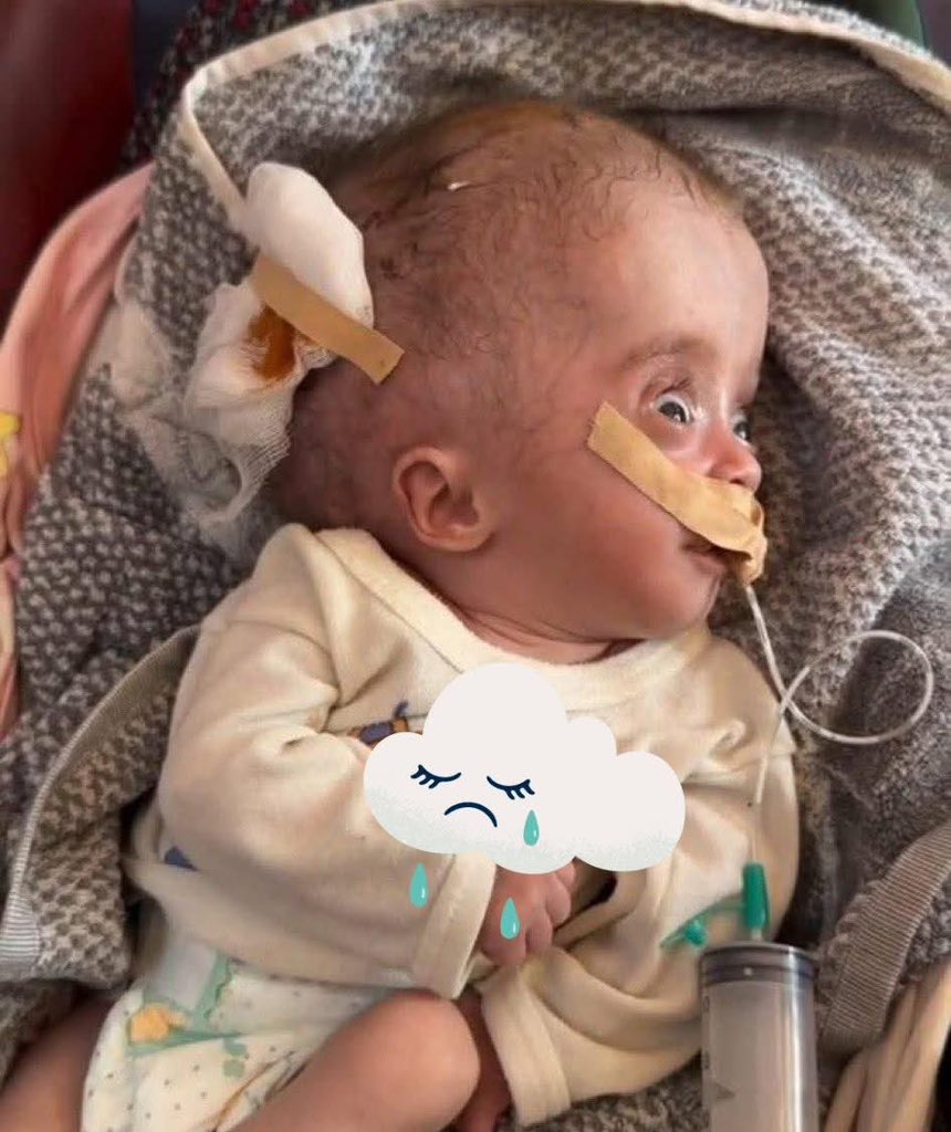 This child just died of starvation

Don't be silent, your silence is betrayal

If you’re scrolling, PLEASE leave a dot.