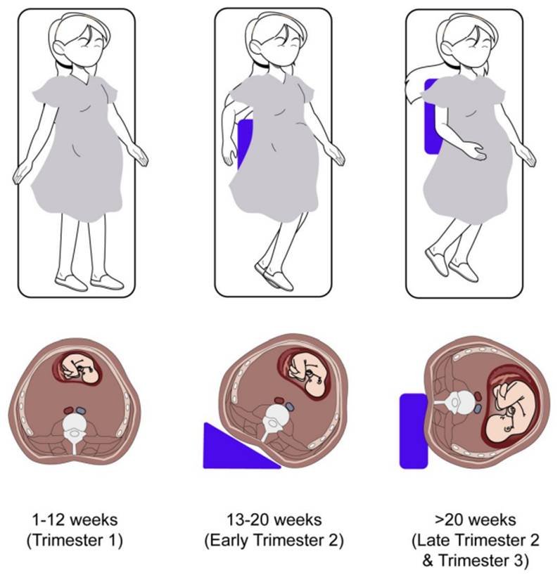 AmJGastro's tweet image. How I Approach It – Performing Endoscopy Safely in Pregnant Patients: Best Practices for the Gastroenterology Team
Lim, et al.
📕 doi.org/10.14309/ajg.0…
@AliFai5al @ErinCiampa @tberzin @MLongMD @JasmohanBajaj