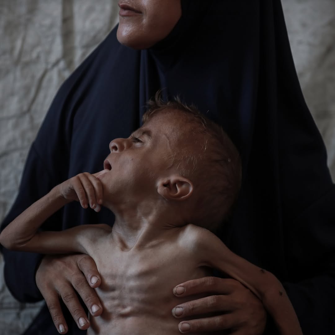 GazaNewsPlus's tweet image. 🔴🇦🇺 [ FLASH INFO ] Le Premier ministre australien à ABC : &quot;Un bébé d&apos;un an n&apos;est pas un combattant du Hamas et les images de la souffrance à Gaza sont inexcusables.&quot;