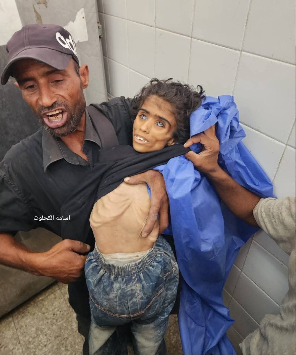الطفلة نور ابو سلعة ماتت بسبب الجوع.

كانت سابقا تنام على ابواب التكيات لتحصل على الطعام، وبعد ان اغلقت التكيات ابوابها ساءت صحتها وعانت من قلة الطعام وانهارت صحتها وارتقت قبل قليل