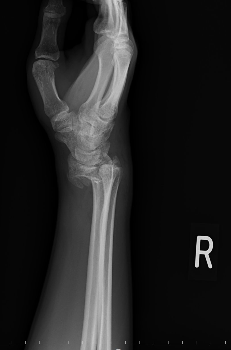 わさびちゃんページ ♡ わさびっち💚オフショ パラパラ先生らんちゃんと自由な中学生