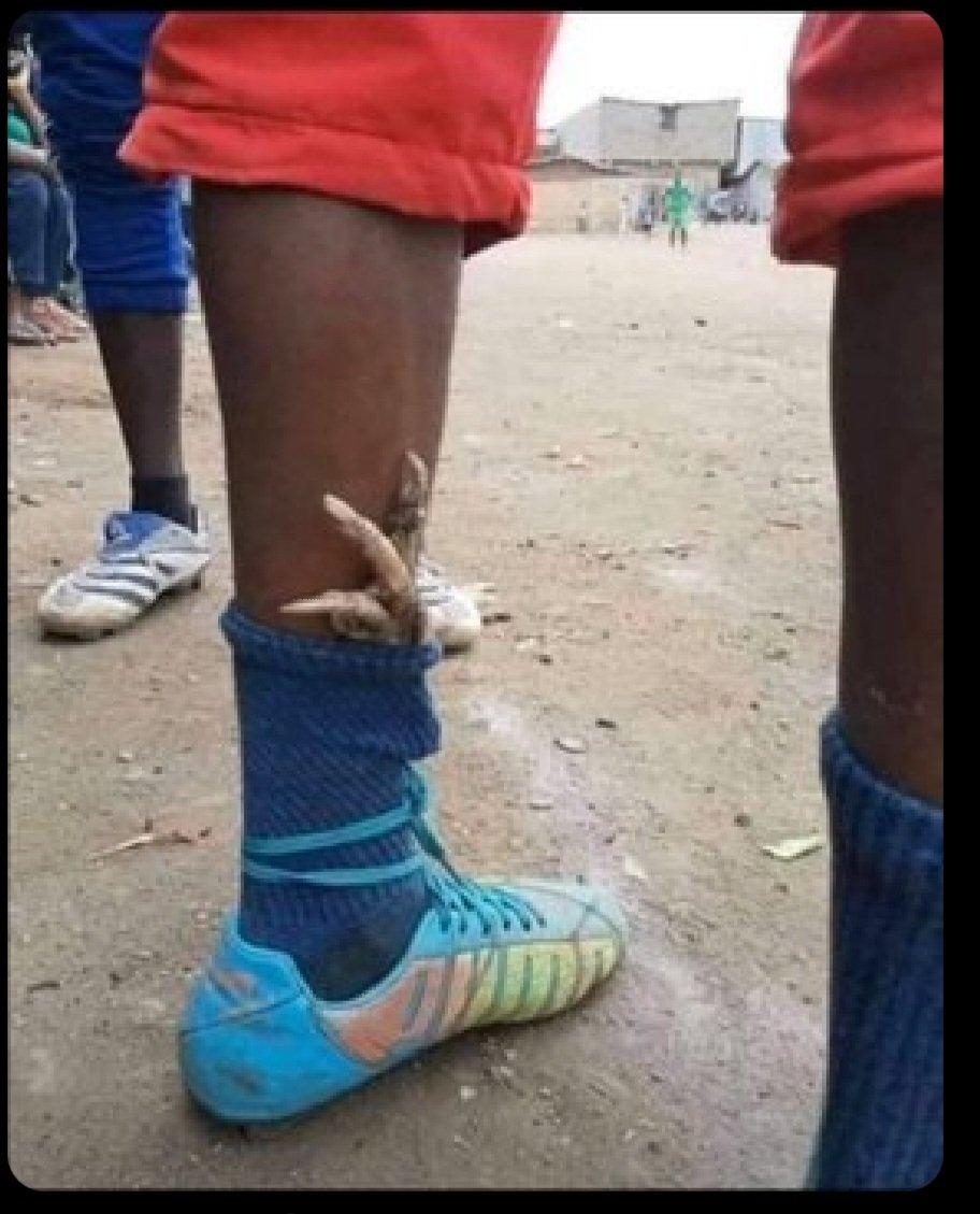 EngEddieMo_Ug's tweet image. The only way Gyokeres can take the golden boot😂😂😂😂😂😂😂😂😂