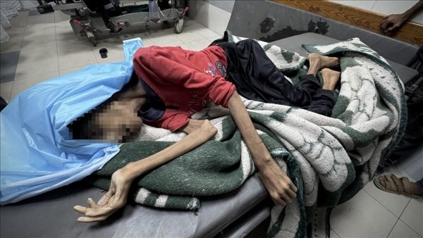 Le Centre euro-méditerranéen des droits de l’homme (Euro-Med ) a révélé  que près de 1 200 personnes âgées palestiniennes ont péri, au cours des  2 derniers mois, à Gaza, en raison de la politique de  famine pratiquée par Israël, de malnutrition aiguë et du déni de soins.