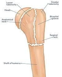 MoAImam's tweet image. Proximal humerus fractures: common yet complex. Early diagnosis and tailored treatment are key to better outcomes. Dive deeper at DeepDiveOrtho.com #TheArmDoc
🎧 podcasts.apple.com/gb/podcast/dee…
▶️ youtube.com/playlist?list=…
#TheArmDoc