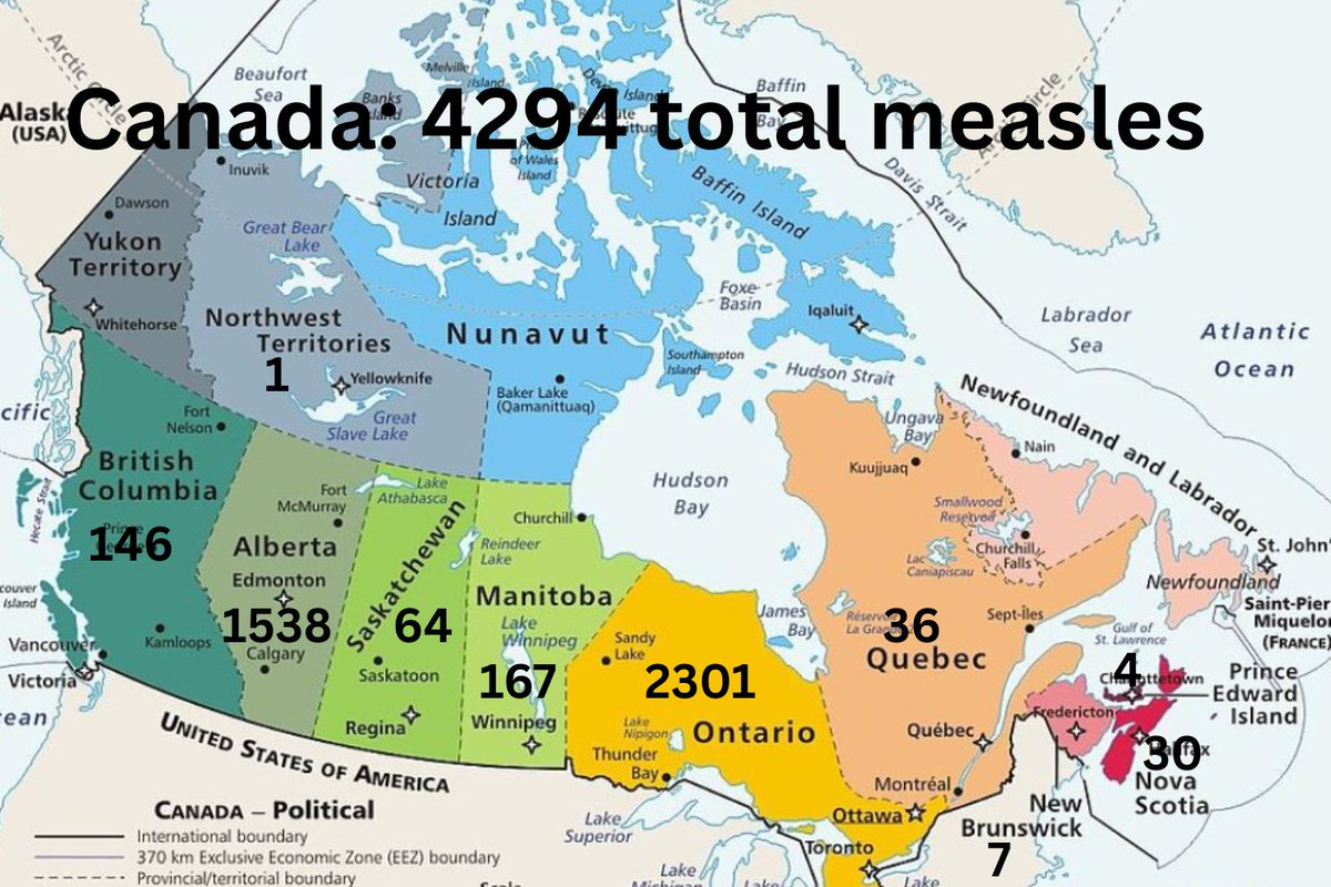bactiman63's tweet image. #Canada #measles #ontario #alberta #manitoba #britishcolumbia #novascotia #quebec #saskatchewan