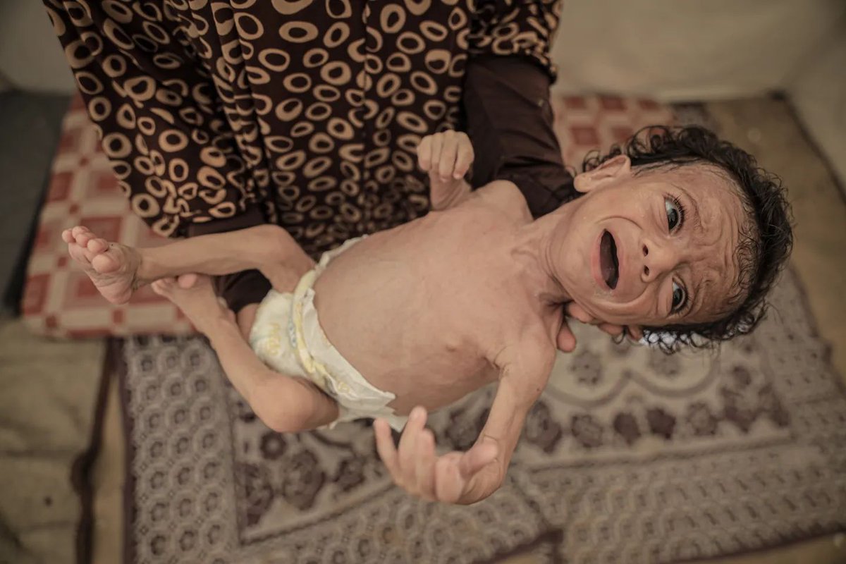 trt_espanol's tweet image. Más de 100.000 niños en Gaza están al borde de morir de hambre debido al salvaje asedio israelí, que bloquea la entrada de alimentos y medicinas esenciales, agravando una crisis humanitaria sin precedentes
trt.global/espa%C3%B1ol/a…