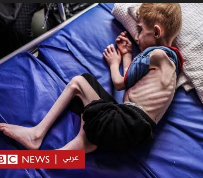 كيف لا نفرح بإنفراج الأزمة ولو جزئياً وعودة دخول بعض شاحنات المساعدات الإنسانية الي قطاع غزة أياً كان سبب أو طريقة دخولها
كيف لا نفرح بإغاثة هؤلاء الجوعي وإنقاذ تلك الأجساد البالية
نعم لم يكن الإنجاز في دخول المساعدات ولكن كانت الجريمة الكبري هي السماح بحدوث تلك المجاعة القاتلة💔