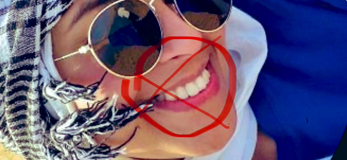 <a href="/Tanaz___/">طناز ارجمند</a> طناز ،خنده ات تو عکس پروفایلت بدجور میره تو اعصابم😁نشون میده دندون‌هات رو وقتی ارتودنسی کردی سیم هات رو دیر برداشتن و دندون‌هات خیلی زیادی بیرون زده! 

دکترت اصلا خوب نبوده دختر! 
یک سفر بیای اسرائیل یا سوئیس، شاید برات مجانی درست بشه!؟😉 
#همكارى_ملى