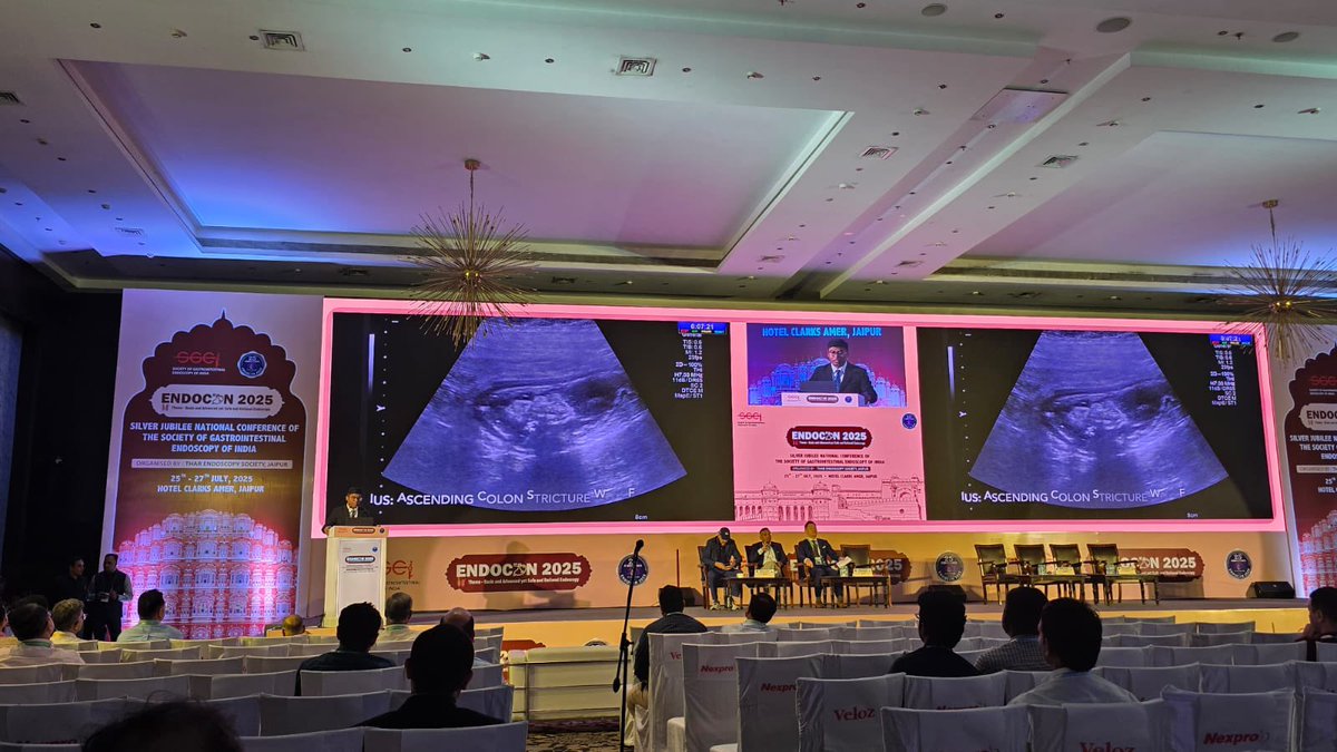 ibd_pal's tweet image. 🏆 Fortunate to win 1st Prize at the Presidential Plenary at #ENDOCON2025!
🎥 Also had the privilege to present our case at Video Digest — showcasing cutting-edge #IBD endoscopy.