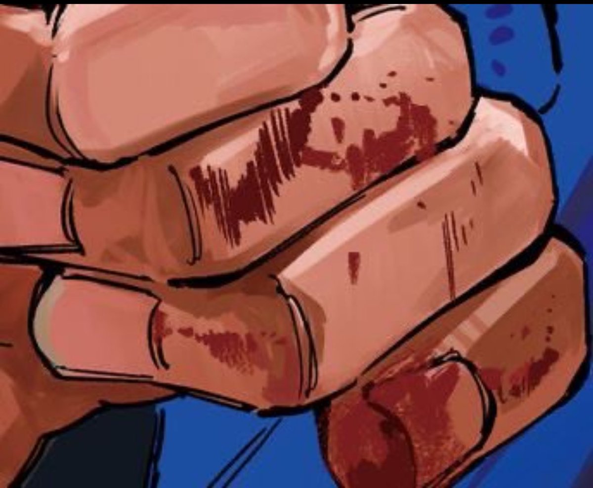 02kiuro's tweet image. please make him wipe his nosebleed