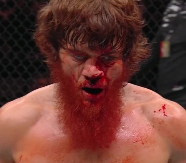 InTheCagePL's tweet image. 🚨Sześciokrotne liczenie, złamany nos i operacja oka... Troje zawodników trafiło wczoraj do szpitala po brutalnej gali #UFCAbuDhabi.
Czytaj więcej: inthecage.pl/trzech-zawodni…
foto: Zuffa LCC, screen UFC Fight Pass