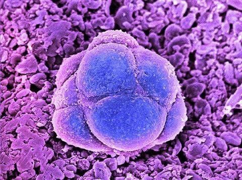 manuelmuro5's tweet image. Micrografía de células madre embrionarias humanas.