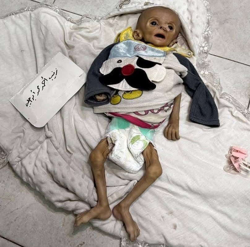 IrrumAli's tweet image. This is Zainab Abu Halib. 
She was 5 months old.
She was starved to death through siege and blockade.

When she died, she weighed less a newborn.

This isn’t war.
It’s deliberate. It’s genocide.

If her image doesn’t rip your soul open, what will?
Speak. Scream. Share. Stop this.