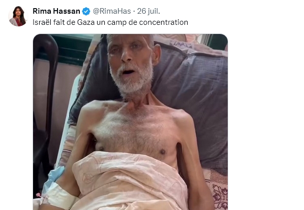 Outofnone1's tweet image. Ce post n'a qu'un seul objectif : répandre sa haine antisémite, en faisant des Israéliens des Nazis, et donc en minimisant la Shoah. La réalité : cette photo n'est pas sourcée, pas datée, avec aucun contexte (cet homme est certainement malade), et ne dit donc rien en soi. 🫤