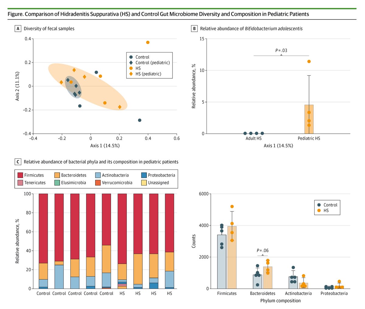 JAMADerm's tweet image. This case series reports an analysis of the gut microbiome in 8 patients with hidradenitis suppurativa and 8 matched controls, emphasizing the pediatric population. ja.ma/46enp9H