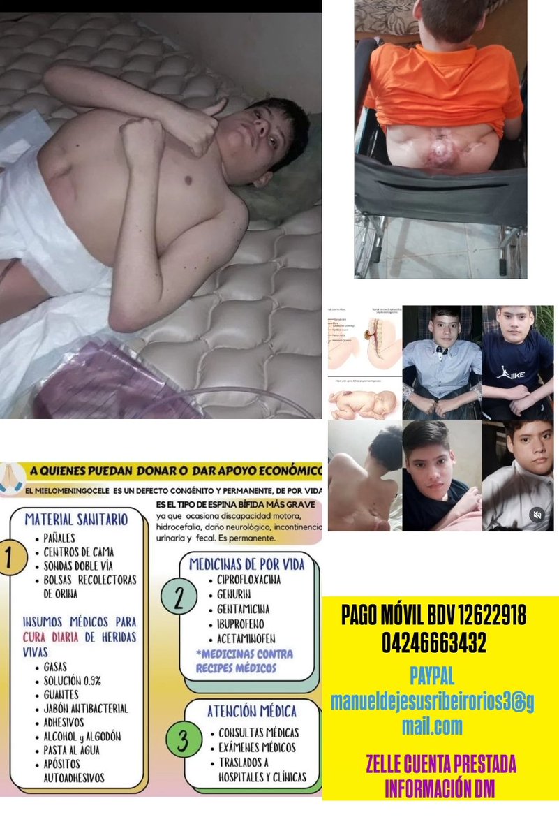 manuel02101's tweet image. Hola 👋 Agradezco a quienes puedan ayudar, mí caso es de por vida,muchas gracias de antemano, bendiciones 🙏 Venezuela estado Zulia.
