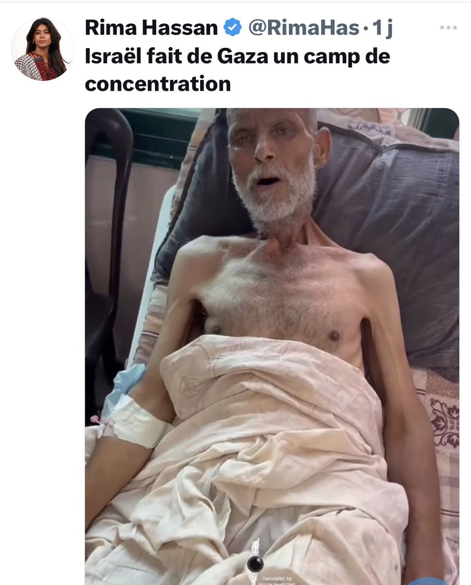 Sans_Concession's tweet image. Les députés de LFI operants pour le Hamas
diffusent de fausses informations 
pour tromper le peuple de France.
Voici un exemple d’une photo d’un turc en 2008 malade qui est utilisé par LFI , comme une personne de Gaza personne victime d’une soi-disant famine 
LFI sont des escrocs