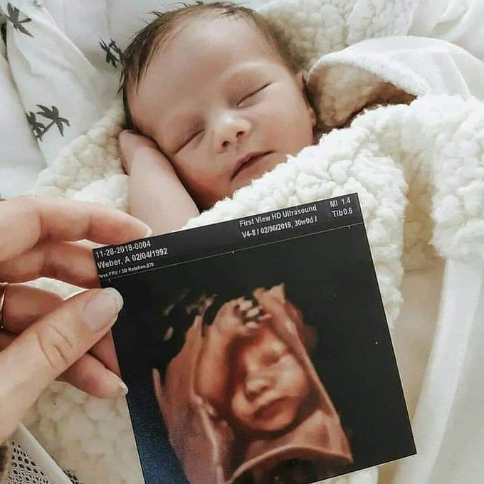 Baby. Before and after birth.