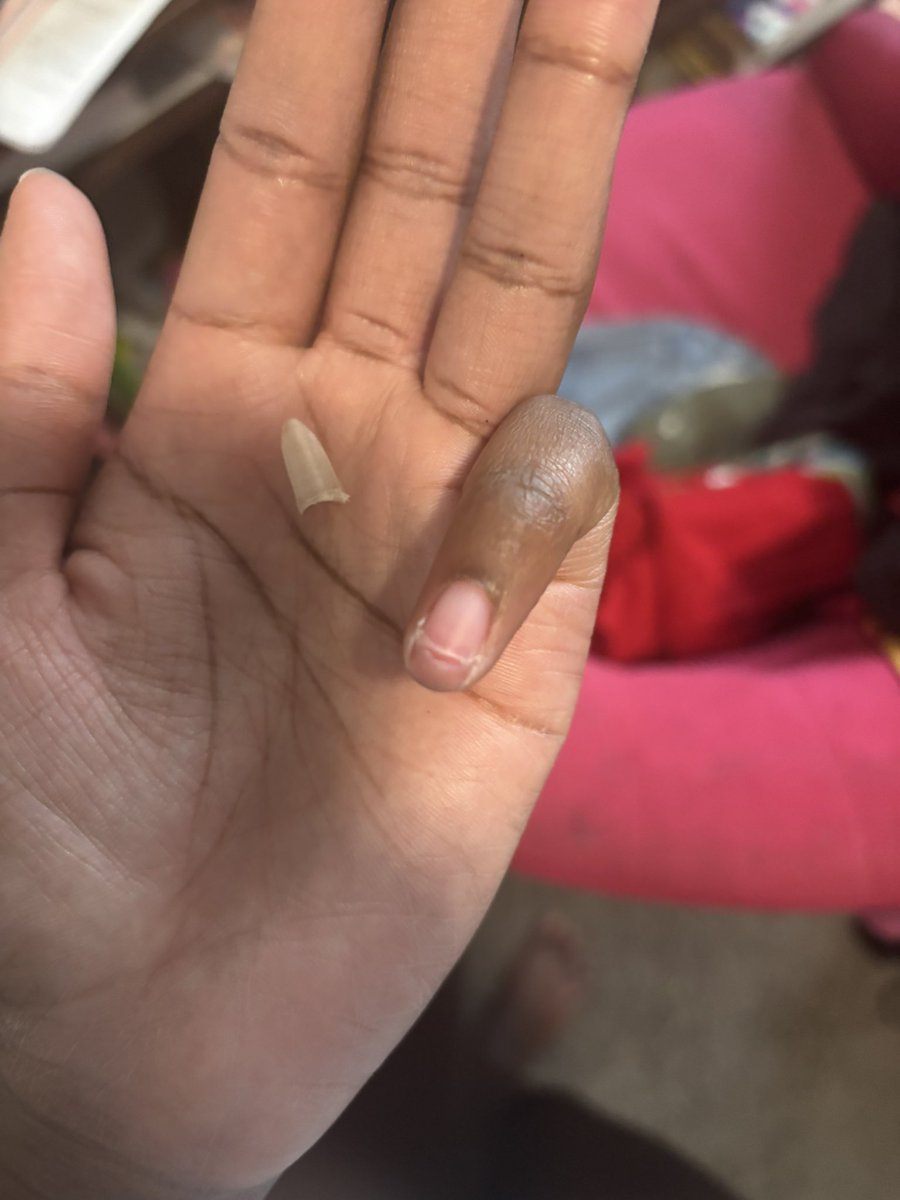 nessqueef's tweet image. Rip Akuinas left piny nail…you served a great time🥹💔
Jan 2025- July 27th 2025