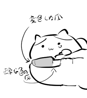 marupokodon's tweet image. この数カ月、足の親指が●んでましたが
ありがたいことに、綺麗な爪が生えてきました。
現時点で凄いゆがみ方してるので、結構痛い。