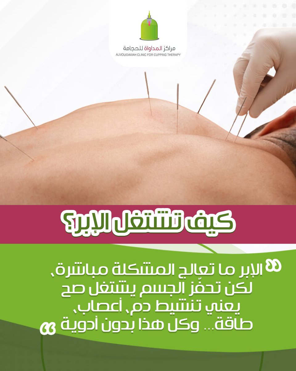 Almoudawah's tweet image. كيف تشتغل الإبر الصينية؟
الإبر ما تعالج المشكلة بشكل مباشر… لكنها ترجع توازن جسمك!
تحفّز الأعصاب، تنشّط الدورة الدموية، وتفتح مسارات الطاقة المغلقة.
والنتيجة؟ جسمك يبدأ يعالج نفسه… براحة وبدون أدوية.
لو عندك صداع، شد عضلي، أو تعب مزمن…
جرّب جلسة إبر صينية مع مختص في فرعي…