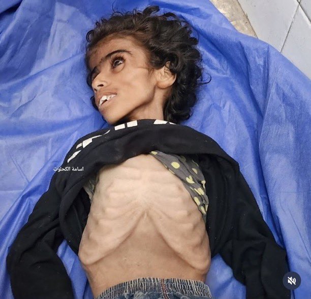 🚨10-year-old Baraa Abu Silas has died of starvation in Gaza. The Ministry of Health says six more Palestinians have starved to death in the past 24 hours alone.

Gaza humanitarians report no aid trucks have entered Gaza so far today—despite Israeli announcements Saturday of