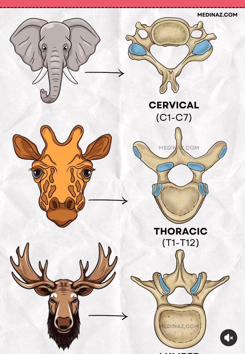 MoAImam's tweet image. Spine resemblance