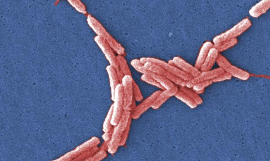 bactiman63's tweet image. #Legionnaires&apos; Disease cluster investigated in #Harlem   #NewYorkCity   #legionella open.substack.com/pub/outbreakne…
