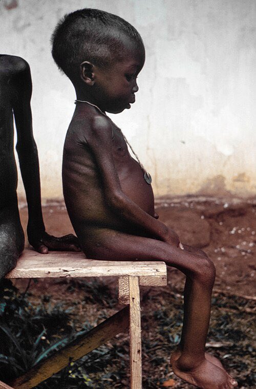 To understand the use of starvation as a weapon in #Gaza, it’s important to know about #Biafra.

Biafra existed as a country from 1967-1970 after declaring independence from #Nigeria.

Nigeria used famine as a weapon, with results that shocked the world.

A thread. 🧵