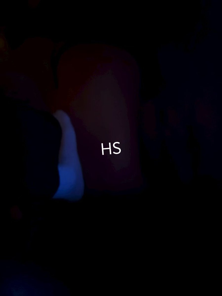 老子大臭脚就该踩在母狗身上 🖕🏻一只脚他妈踩着傻逼母狗的头 一只让母狗用力吸 把老子脚上臭味全部吸狗脑子🧠里