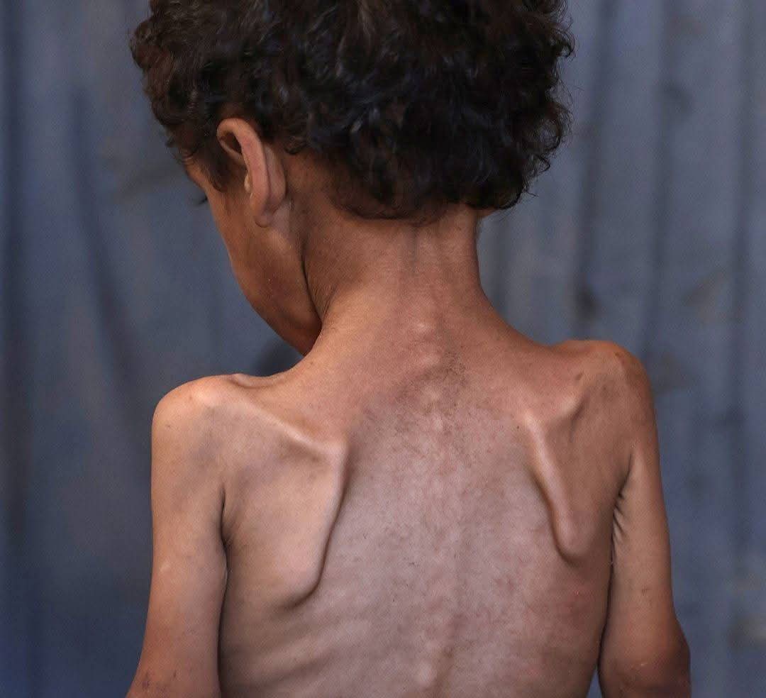 AyeshaRizwan22's tweet photo. This is horrendous!
اللھم انصرھم
#OpenCorridorsToGaza https://t.co/xmTT4N6n1x