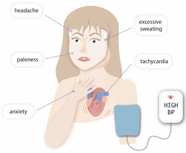 modernHealthMe's tweet image. How will you manage her bp?