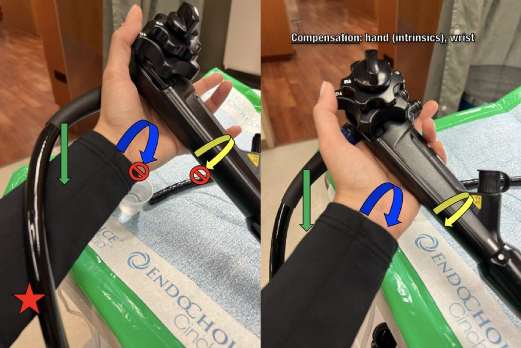 James D. Haddad, MD, FACP (@jameshaddadmd) on Twitter photo Having a great time teaching at #ASGE Fellows course & getting on my #ergonomics scope grip soap box 
⬆️ stability
⬆️transmission of torque
🔻unintended 🔄 around longitudinal scope axis
🔻Less hand/wrist stress (prevents excess flexion, death grip)
#GITwitter #GIX #Endoscopy Having a great time teaching at #ASGE Fellows course & getting on my #ergonomics scope grip soap box 
⬆️ stability
⬆️transmission of torque
🔻unintended 🔄 around longitudinal scope axis
🔻Less hand/wrist stress (prevents excess flexion, death grip)
#GITwitter #GIX #Endoscopy