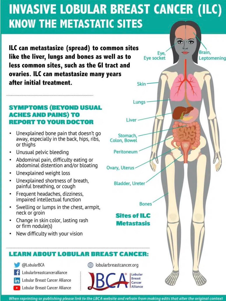LobularIreland's tweet image. Invasive lobular carcinoma (ILC) the most common special histological subtype of #breastcancer accounting for 15% of cases. ILC has unique clinical and molecular characteristics.
Info graphic from @LobularBCA
Share with your Clinicians
#NotAlwaysALump