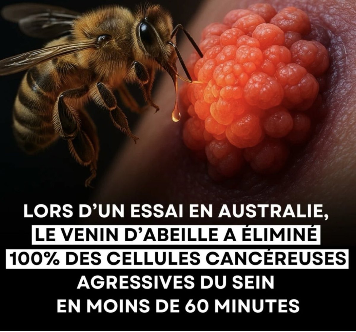 En Australie, une dose de venin d'abeille a éliminé 100 % des cellules du cancer du sein triple négatif -  en 60 minutes.
Aucune chimiothérapie.
Juste une protéine naturellement présente dans le venin: la mélittine.
Source:(Harry Perkins Institute of Medical
Research, Australie)