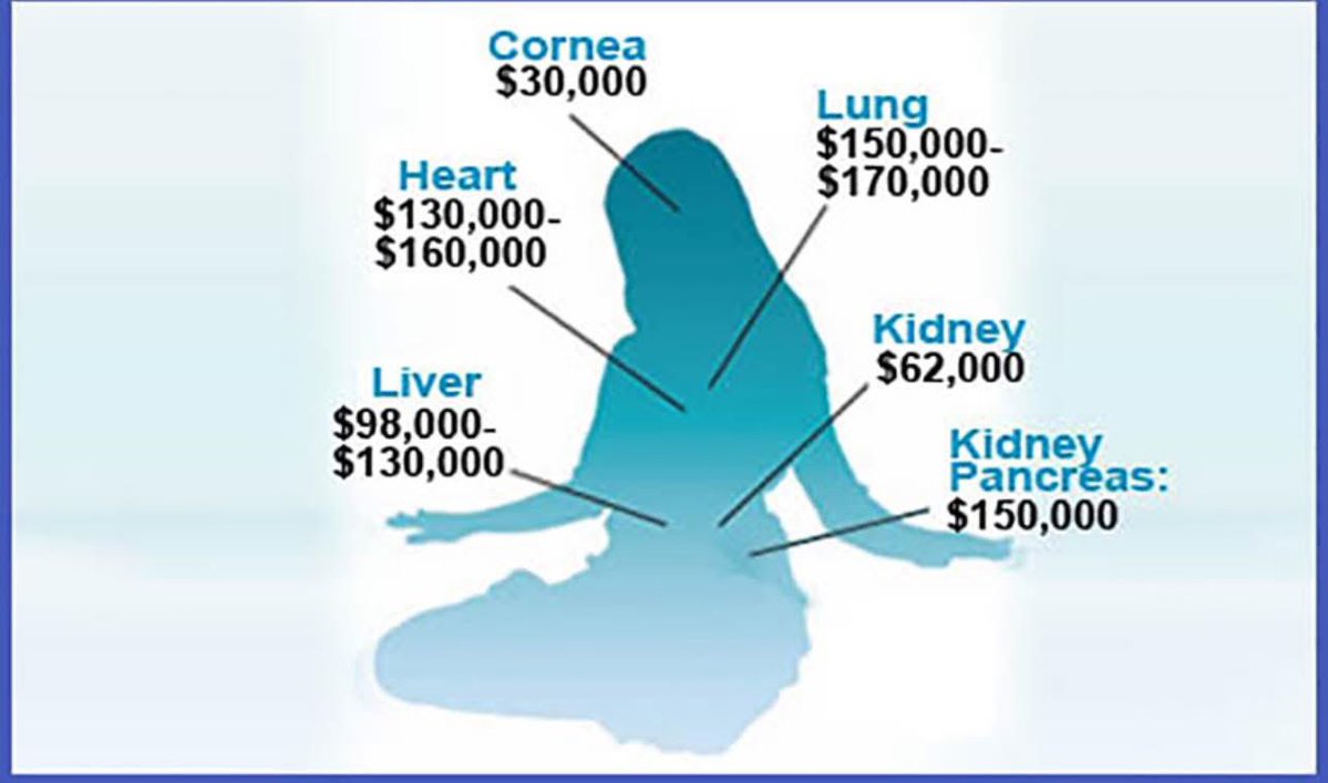 BlondeKbf's tweet image. Never ever sign up to donate your organs