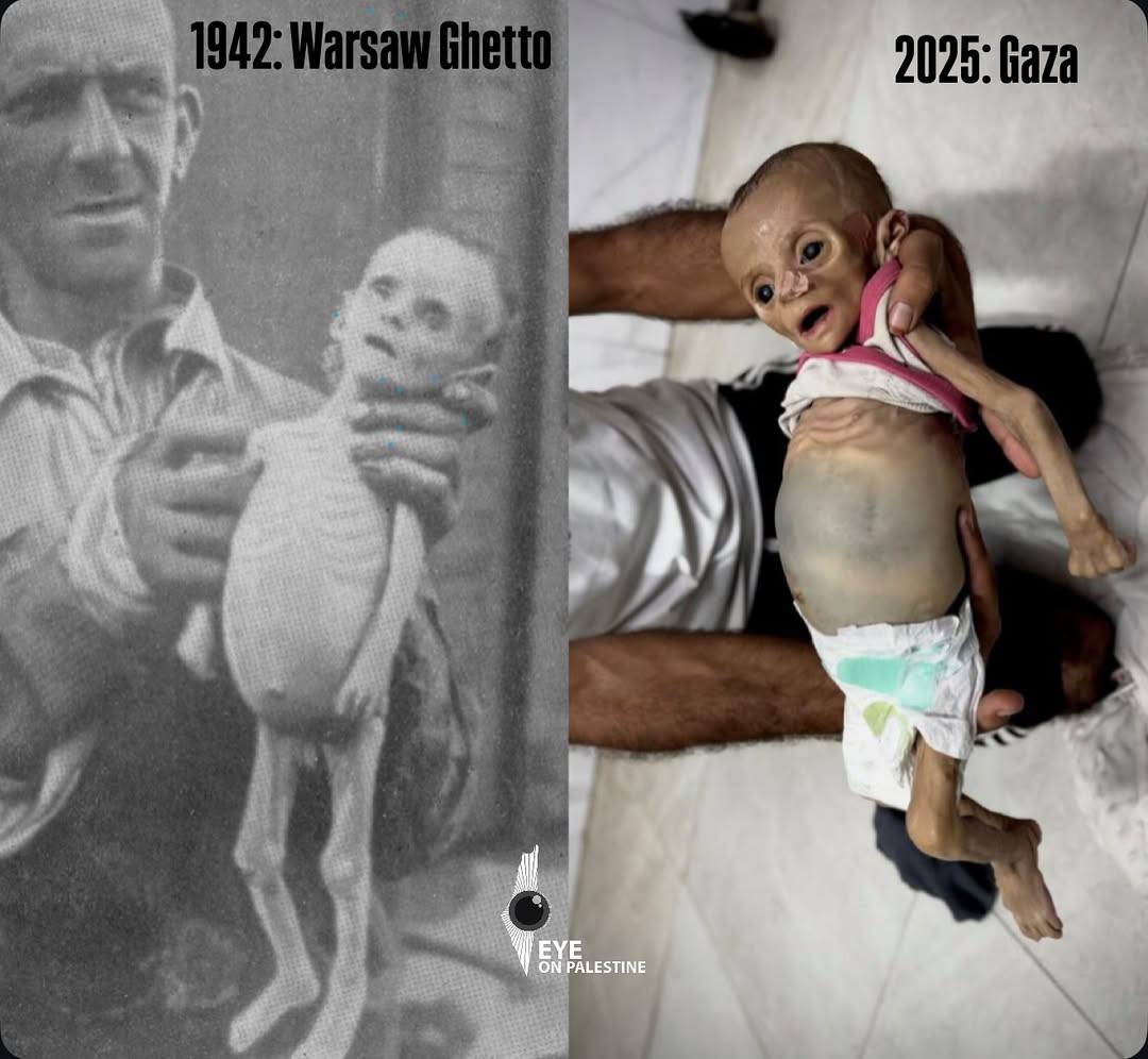 La bebé palestina de 6 meses, Zainab Abu Halib, murió en el Complejo Médico Nasser de Gaza debido a la inanición y la desnutrición severa causadas por el bloqueo israelí.

Según el Ministerio de Salud de Gaza, al menos 125 palestinos, incluidos 85 niños, han muerto por