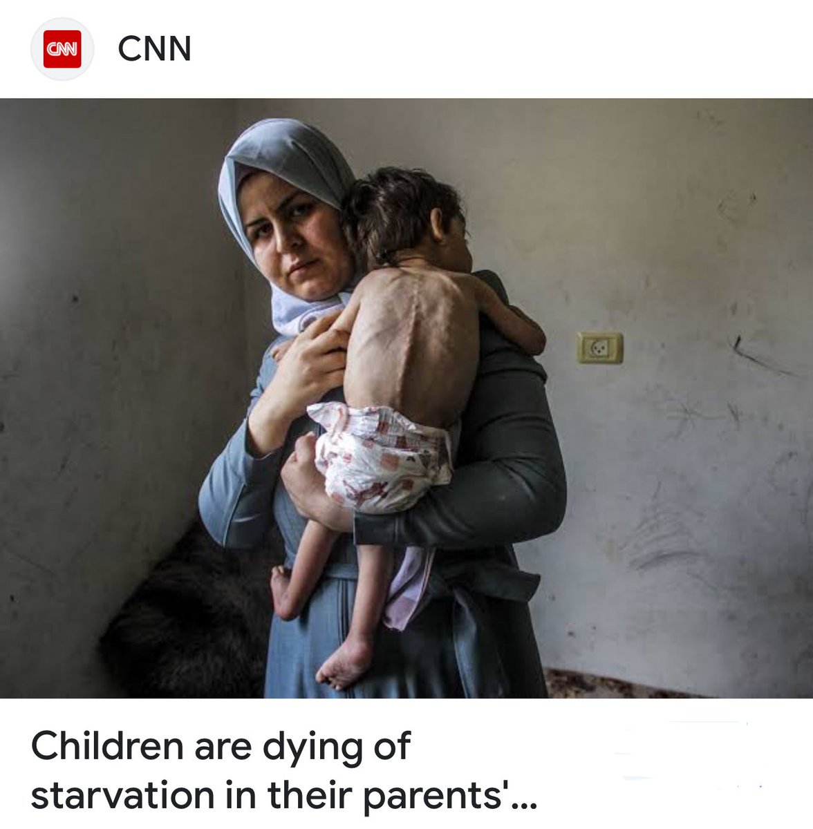 Tafsikorg's tweet image. Starvation is terrible. Son is cerebral palsy. This child is being used. Shame on @CNN @nytimes and every other lying news agency.
This little boy is not starving. He is suffering from cerebral palsy. A medical report issued in May 2025 by the Basma Association for Relief…