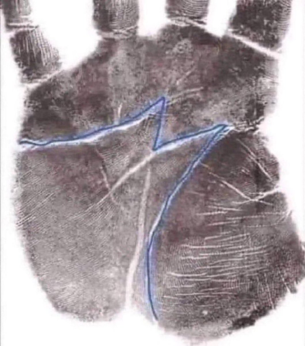 If you have this on your hand that means you are one of the chosen ones

Do you have it?