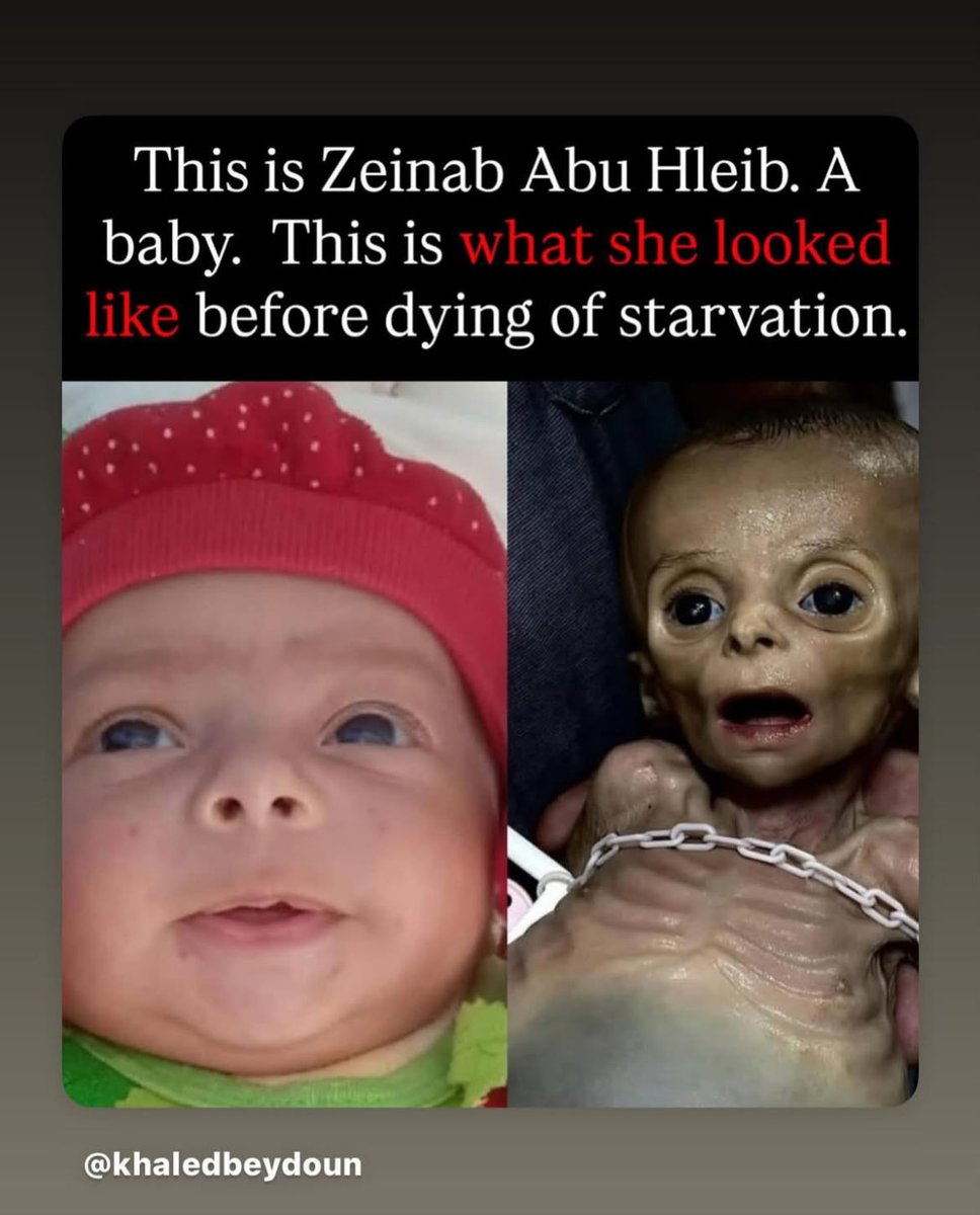 #Gazastarvation #Isrealwarcrimes