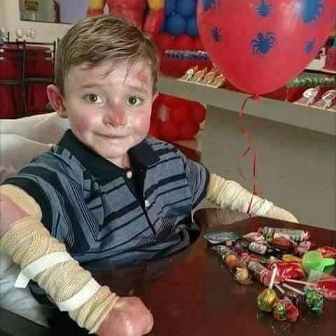 His school friend told him that no one would say happy birthday to him because of his desease 🥺
He is 11 years today 🎁🎉💕💐🥺