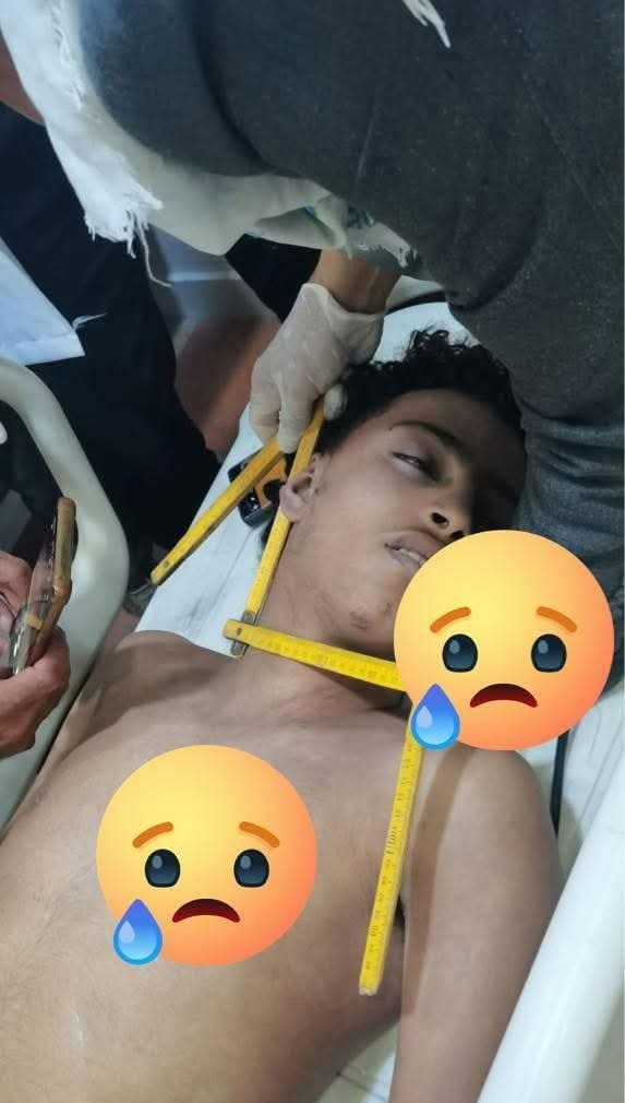 🔴حادثة جديدة في مدينة إب، حيث فقد الشاب علي محمد القاسم حياته أثناء جلسة رقية، بعدما قام المدعو "الشيخ نبيل حارث" بالضغط على عنقه بقدمه أثناء تلاوة القرآن، وفقاً لما ذكرته عائلة الشاب