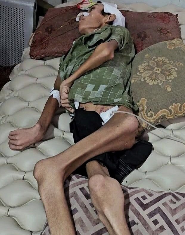 #Gaza is starving to death.. while the world watches! Children licking dirt for crumbs.
Shame on you, West! Your hands drip with Palestinian blood.. Your laws are fraud.. Your humanity is a lie.. History ll remember you as people who saw death daily and chose to be executioners!