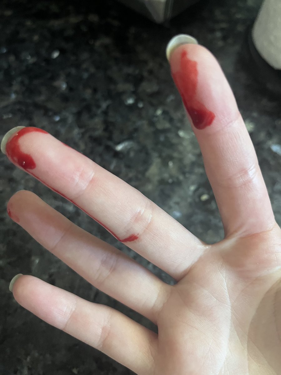 BarfedOnIt's tweet image. stop.. stop.. STOP 🛑