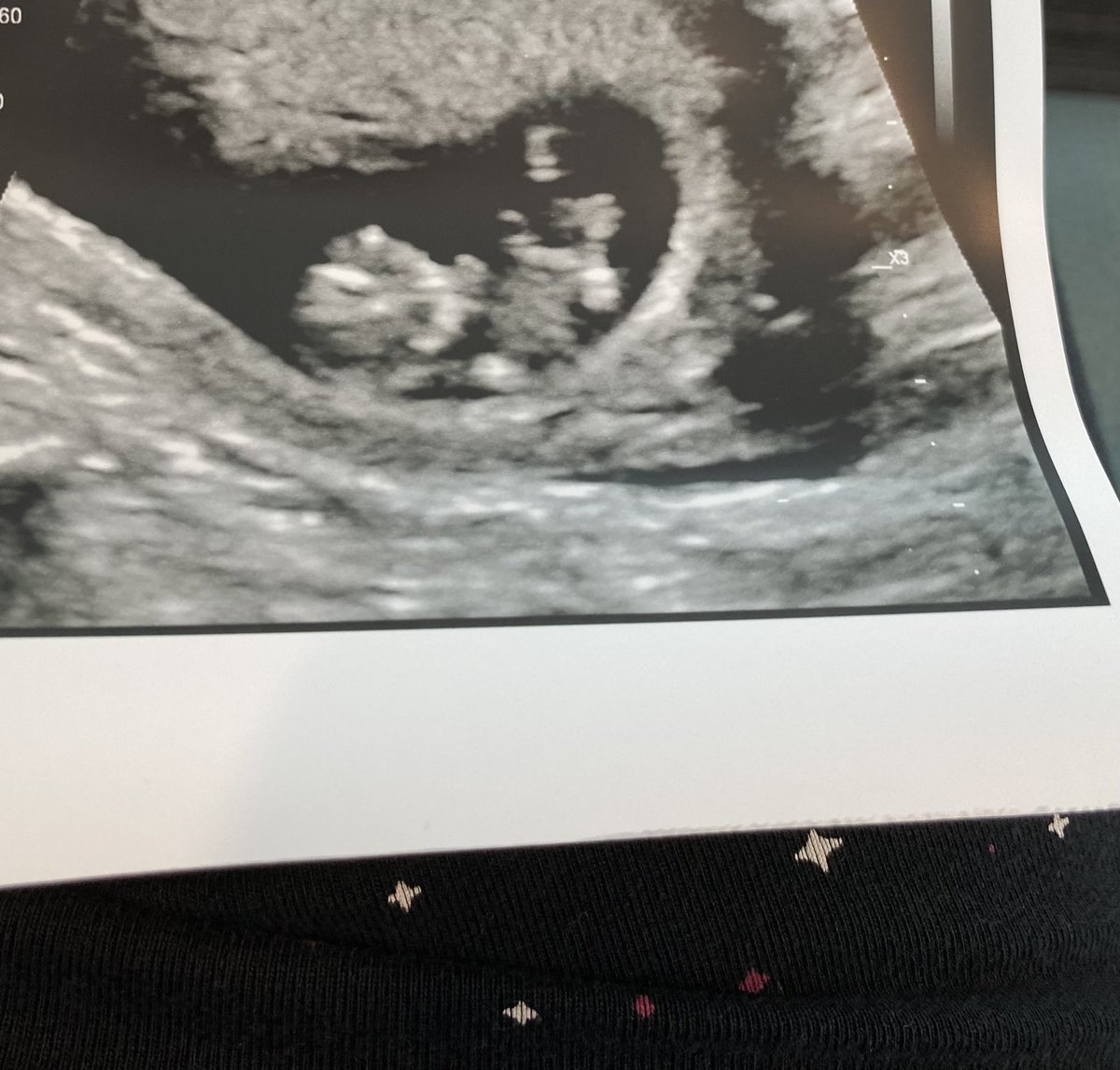 🍂imloved tweet media