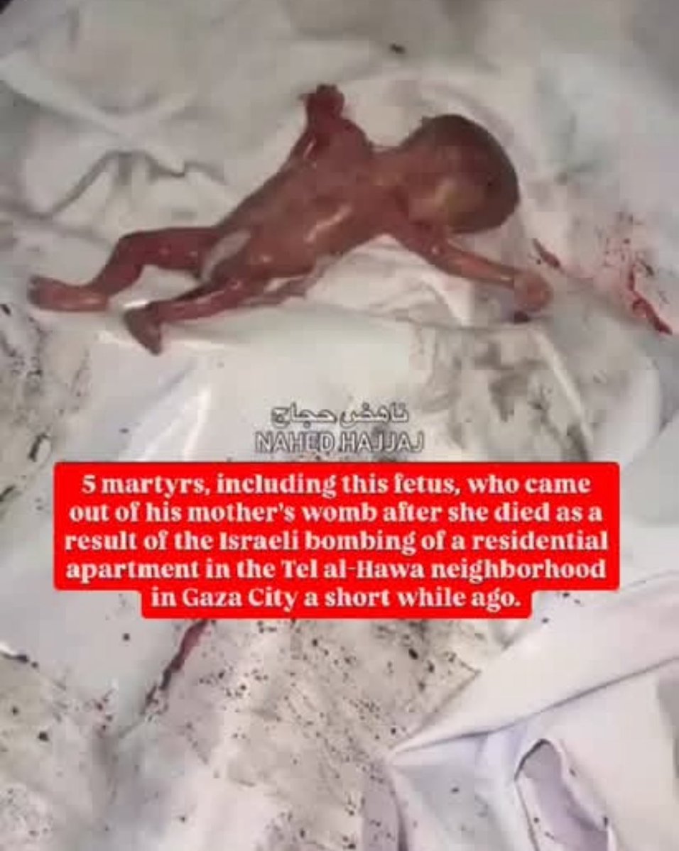 5 martyrs, including this fetus, who came out of his mother's womb after she died as a result of the Israeli bombing of a residential apartment in the Tel al-Hawa neighborhood in Gaza City a short while ago.