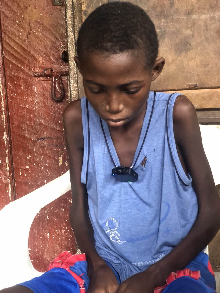 ChernorMomoh01's tweet image. "I'm only trying to be good, but things have not been easy for me since the start of this sick..." 12-yr-old Mahamoud, a liver & Hepatitis B patient seeks help😭. For help/supportContact the family on 075639865. 🙏 @PaAlaki1 @saffajnr @Jeen_Yous @Flyboii_Gbana #SaloneX
