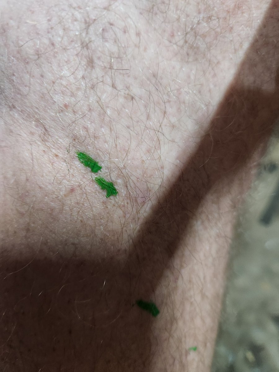 Well fuck,...Bleeding again.